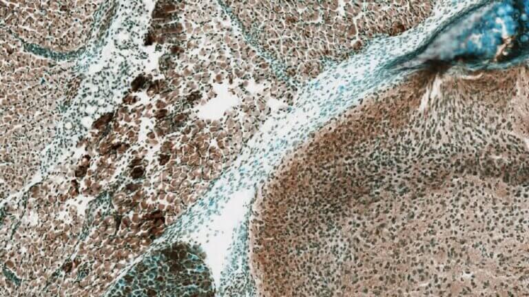 Allen Spinal Cord Atlas Image