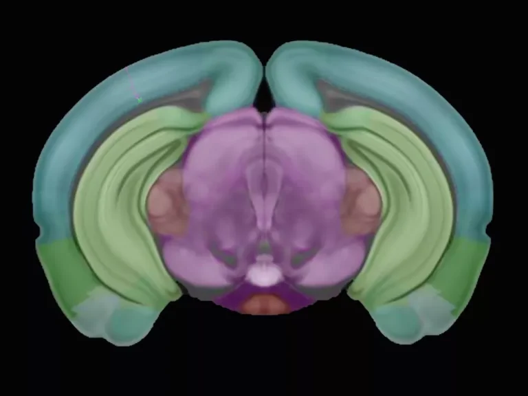 Image of a cross section of a brain.