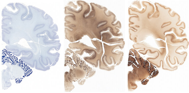 Crosssections of the brain