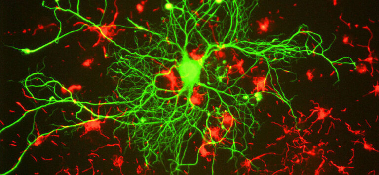 Image of neurons