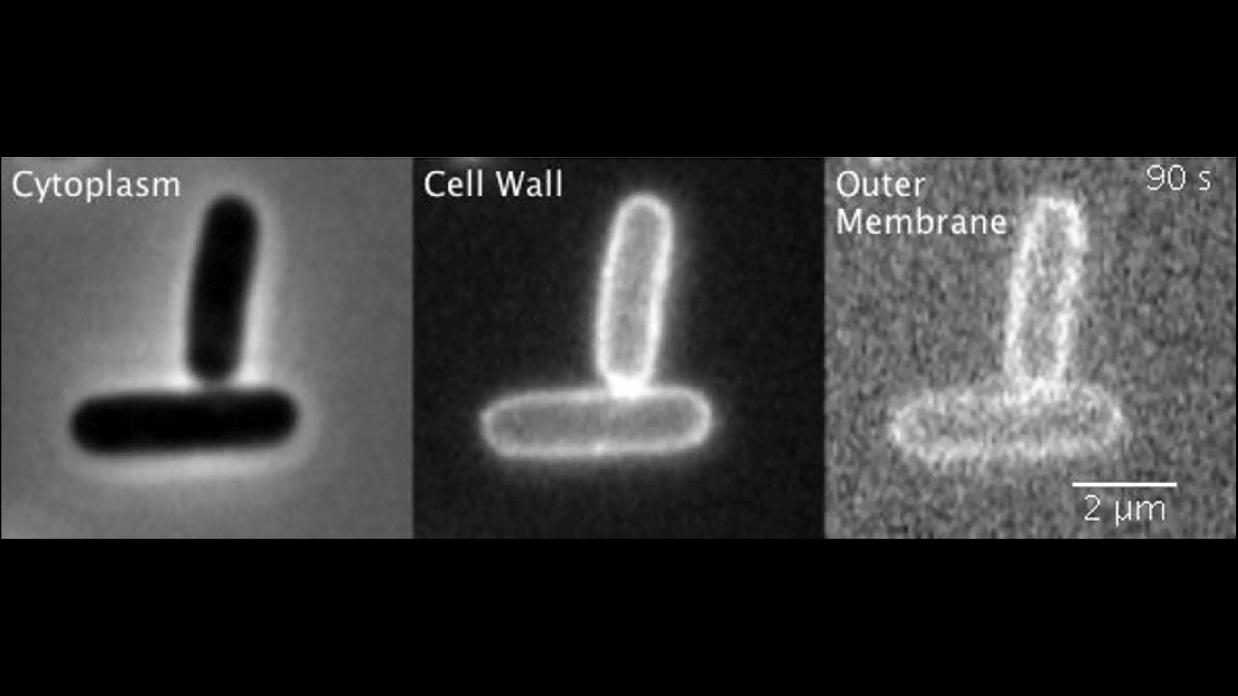 E. coli cells missing both their stiff outer membrane and their cell wall implode during division. A new study led by researchers at the Allen Discovery Center at Stanford University has found that the outer membrane of Gram-negative bacteria has important physical properties that had previously gone undiscovered. Movie courtesy of Enrique Rojas, Ph. D., and Nature.