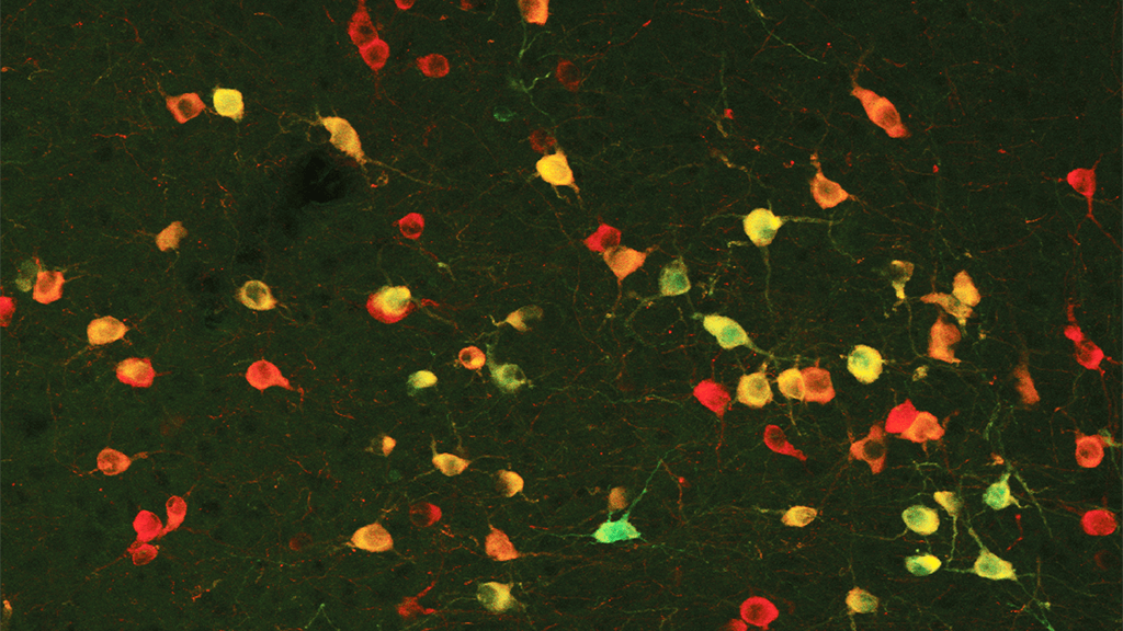 Rare cholinergic neurons labeled with fluorescence in a mouse brain. 