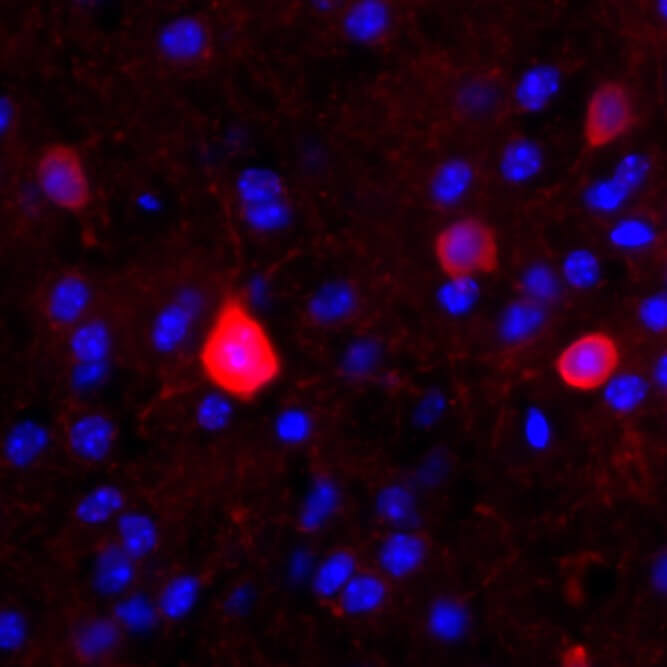 Mouse fast-spiking interneurons labeled with red fluorescence.