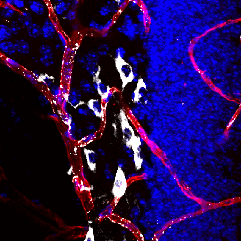 Neuron plasma illuminated in the mouse hippocampus. Image courtesy of Andrew Yang/Stanford University School of Medicine.