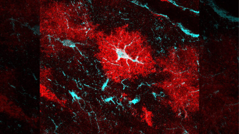 Image of an astrocyte