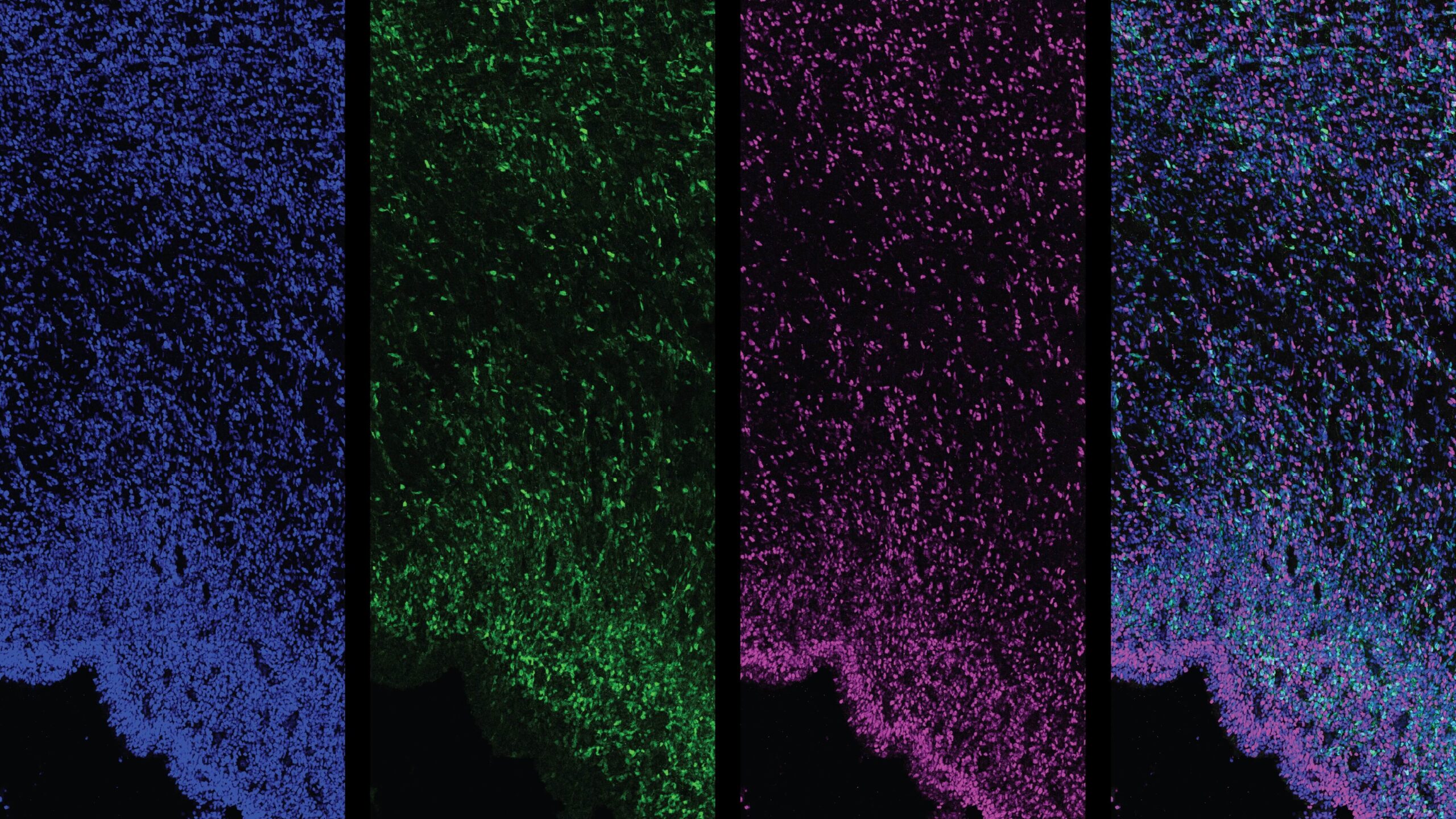 The scientists found that PPP1R17 is expressed in the part of the developing human brain known as the cerebral cortex (PPP1R17 is shown in green in the second panel from the left, all panels show a developing human brain) but not in developing mouse or ferret cerebral cortex. Image courtesy of Ellen DeGennaro/MIT and Harvard.