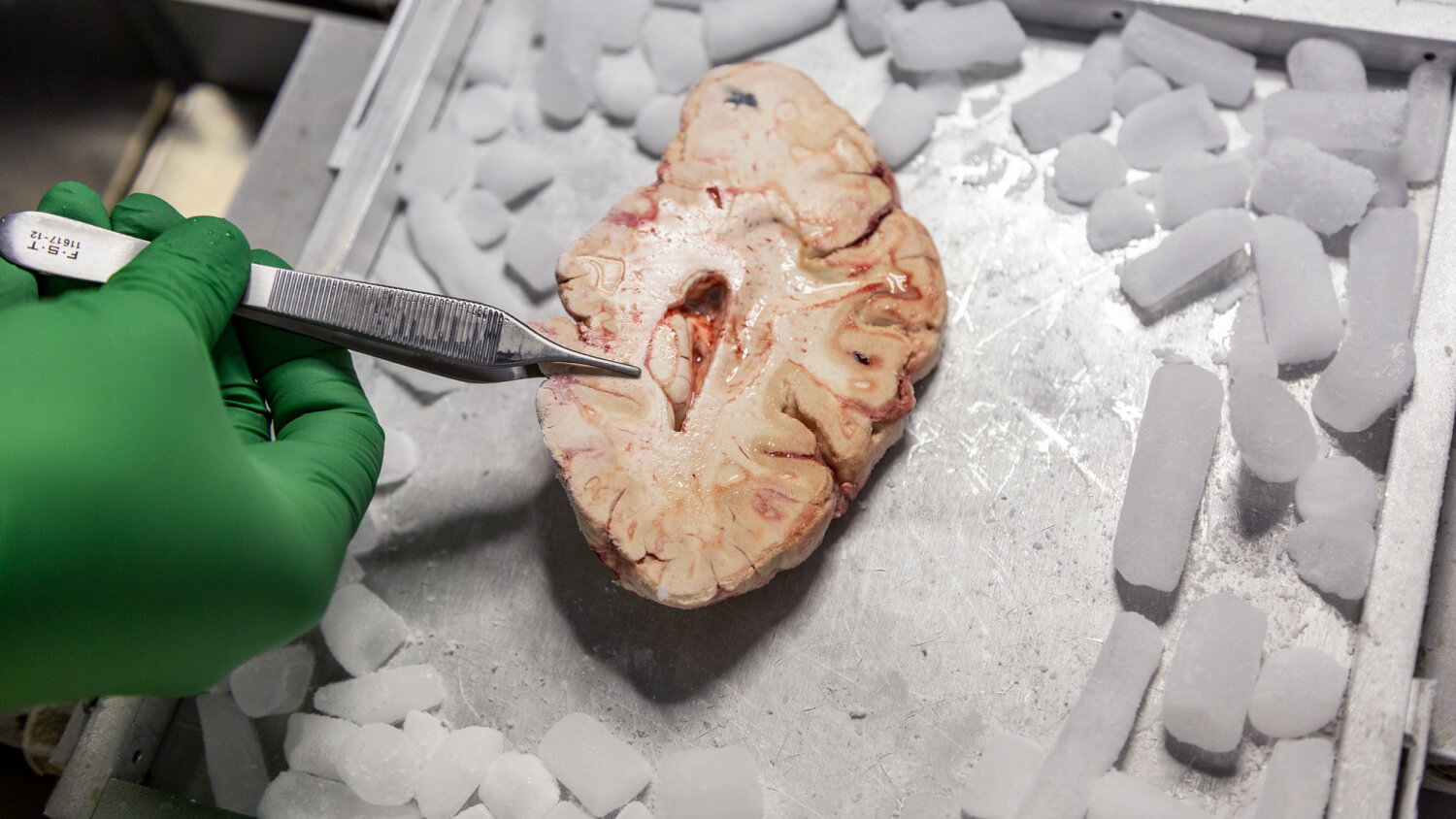 Rebecca Hodge, Ph.D., a scientist at the Allen Institute for Brain Science, holds a frozen slice of a postmortem human brain donated to research. A new effort led by the Allen Institute aims to map the entire human brain at single-cell resolution. Photo by Erik Dinnel / Allen Institute