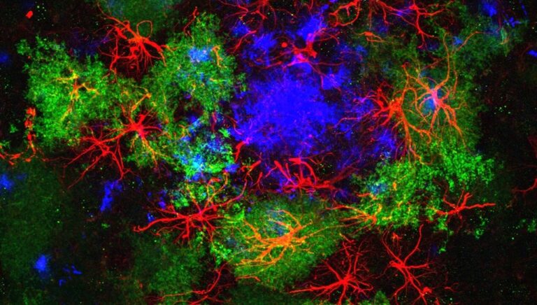 Star-shaped astrocytes in red surround an amyloid plaque in blue against a black background