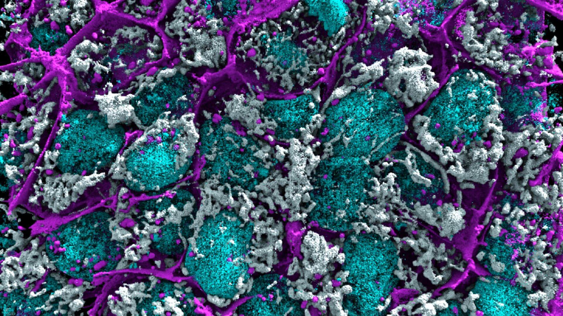 Image of human cells dynamically imaged in high contrast using AGAVE imaging technology.