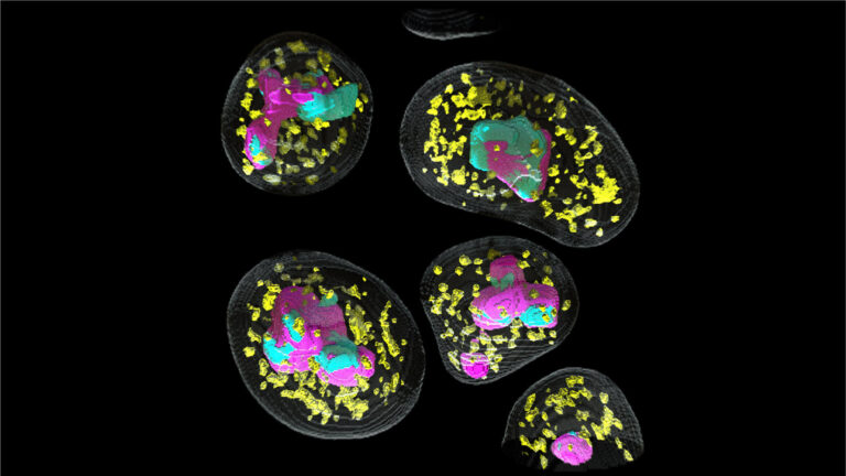 Research teams at the Allen Institute are part of newly launched efforts to understand the cell nucleus. Here, an image from the Allen Institute for Cell Science shows models of nuclei from human stem cells, highlighting two different structures inside each nucleus: nuclear speckles (yellow) and nucleoli (cyan and magenta).