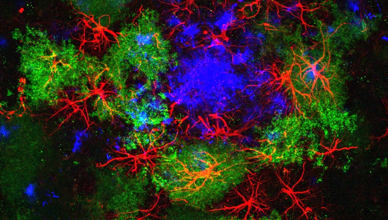 Brain cells named for stars seem to play a role in Alzheimer's disease, a new study finds. Here, the star-shaped astrocytes shown in red surround an amyloid plaque (blue) in a mouse's brain. Amyloid plaques are a hallmark of Alzheimer's. All images courtesy of Baljit Khakh, Ph.D. / UCLA.