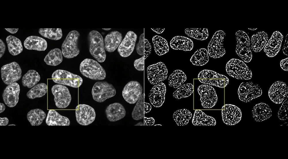 The Allen Cell & Structure Segmenter is a Python-based open source toolkit developed for 3D segmentation of intracellular structures in fluorescence microscope images.