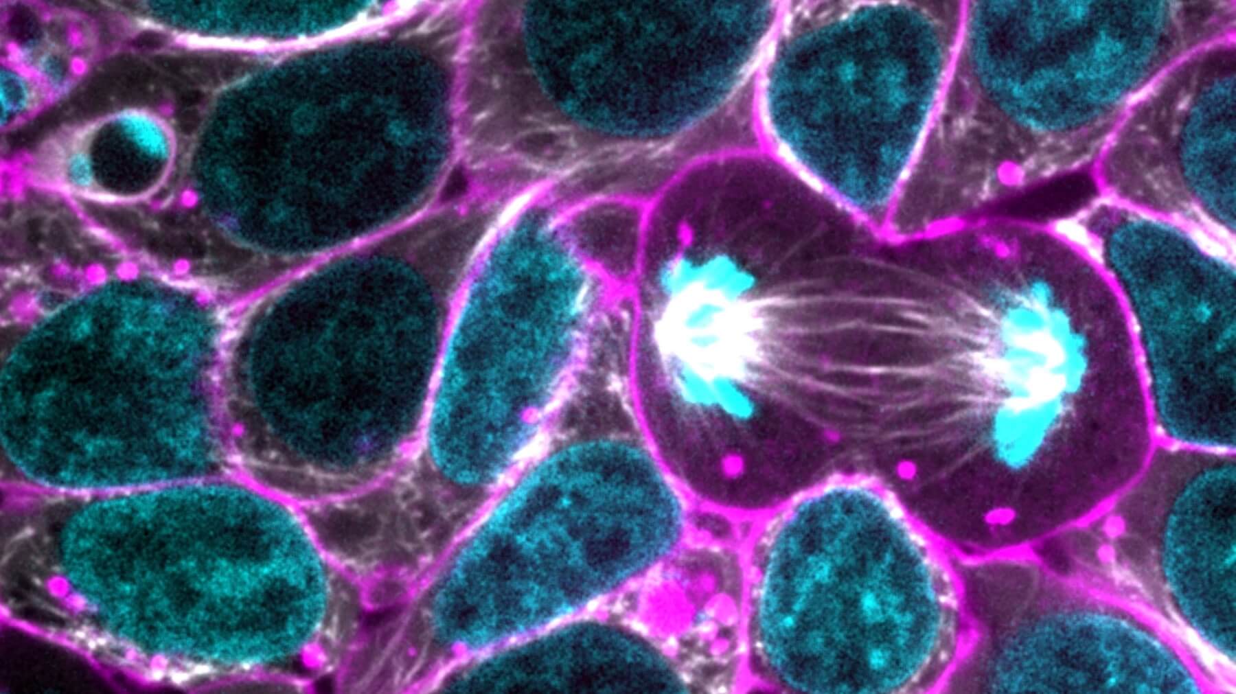 Alpha tubulin illuminated in healthy human iPS cells