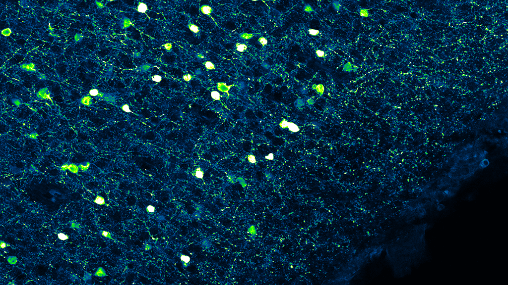Researchers at the Allen Institute for Brain Science label neurons with fluorescence so they can examine certain cell types.