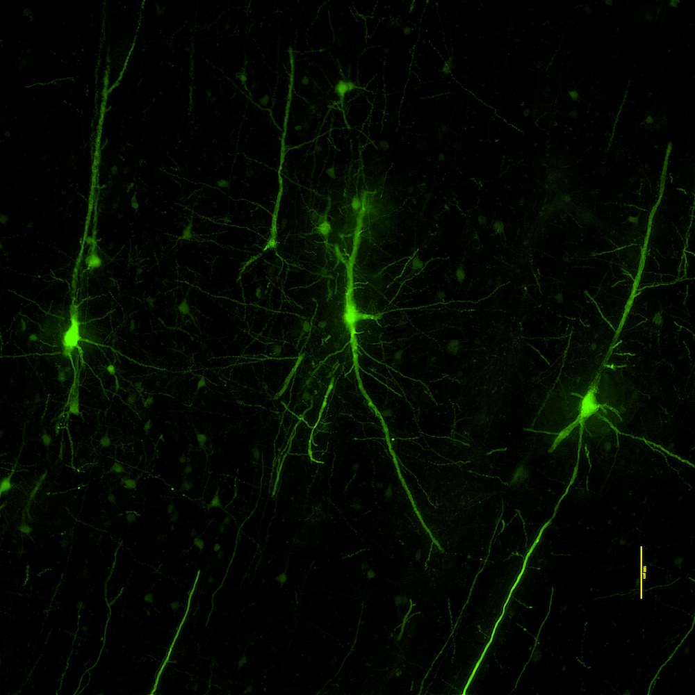 Glowing Betz cells, a huge type of specialized motor neuron found in primates but not in rodents, in the macaque monkey brain. Scientists at the Allen Institute label these neurons using a modified virus that is capable of delivering fluorescent cargo to a specific class of neuron in the brain.