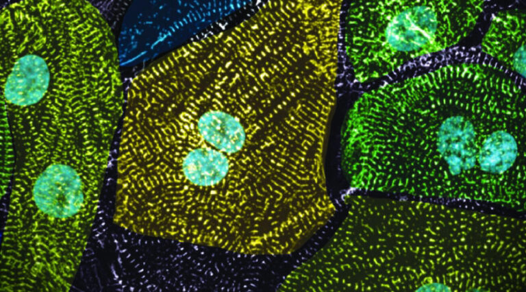 Allen Institute researchers have found that there’s more to our cells than genes alone reveal. Here, an image of human heart muscle cells, or cardiomyocytes, grown from human stem cells shows the variability in organization among structures inside the cells.