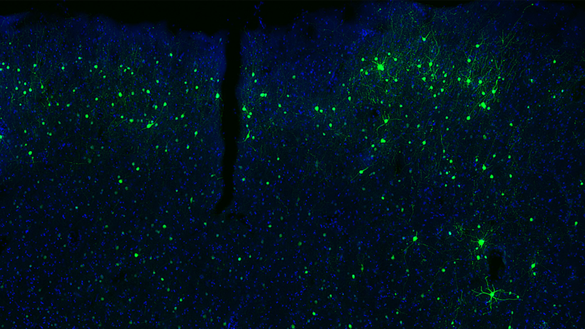 A new technique lets scientists watch live neurons in glowing color. Here, a piece of human brain tissue, donated by a patient undergoing brain surgery in the Seattle area, is lit up in green and blue thanks to a modified virus that delivers fluorescent labels only to a single class of neuron in the brain. Green cells are inhibitory neurons; blue are all cells.