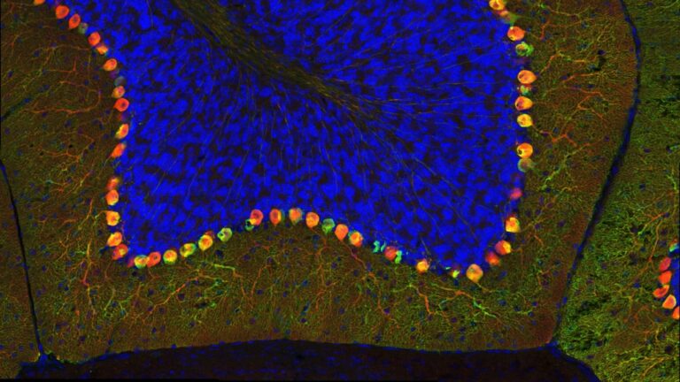 Image of a brain