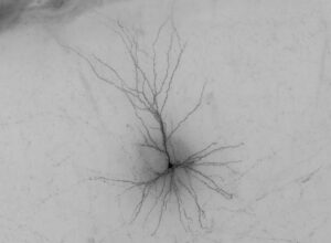 A spiny neuron, one of the three classes of brain cell types found to be linked to schizophrenia