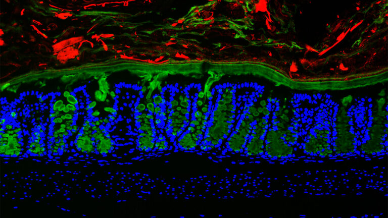 A microscopy image of a section of a mouse colon, showing a protective layer of mucus in green that is often disrupted in human inflammatory bowel disease, or IBD. A team of newly announced Allen Distinguished Investigators is investigating how immune cells, metabolism, gut bacteria and people’s environments contribute to disease variability among IBD patients. Image courtesy of Katharine Ng, Tropini Lab, University of British Columbia.