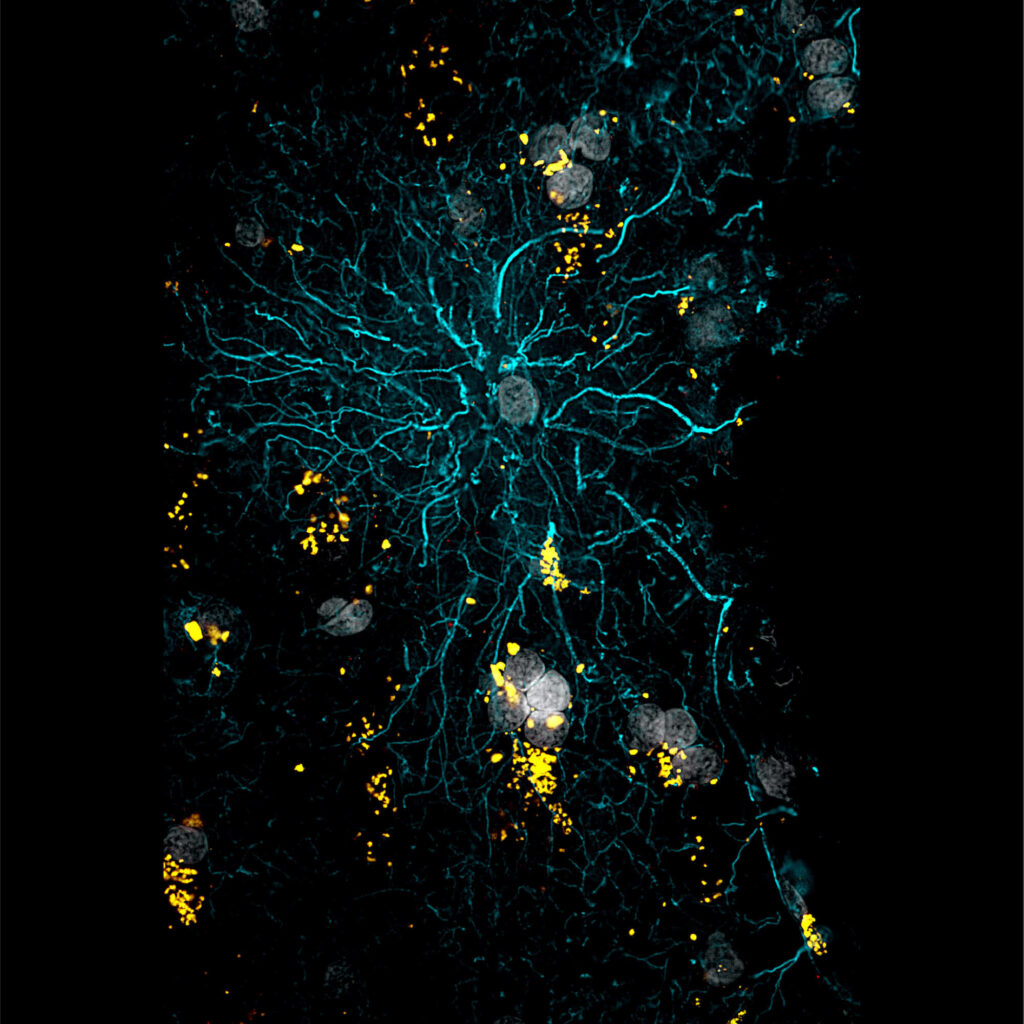 SciShots: A star-shaped human brain cell - Allen Institute