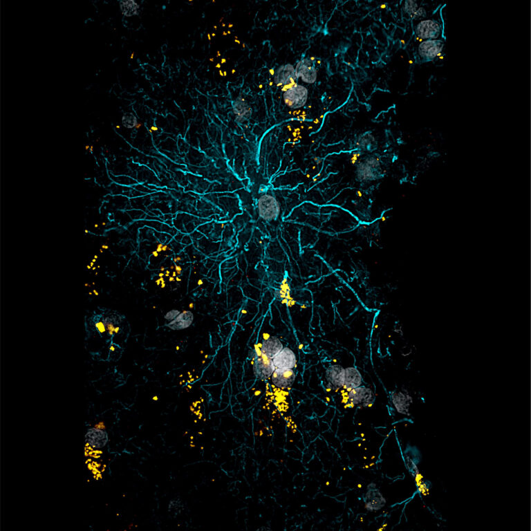 Image of astrocyte