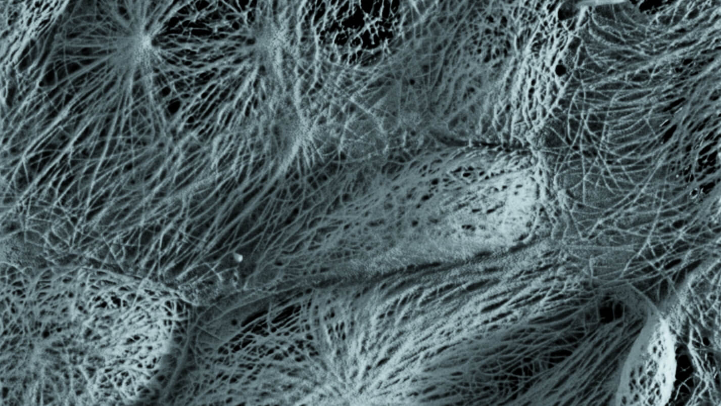 Image of microtubules