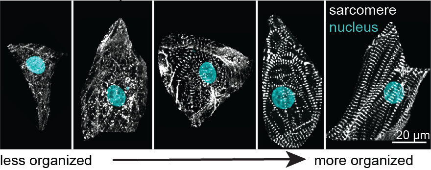 The research team developed an “organization score” to sort more than 30,000 images of cardiomyocytes into five categories. The images showed organization of the cells’ sarcomeres, which go from jumbled to parallel stripes as the heart cells mature. 