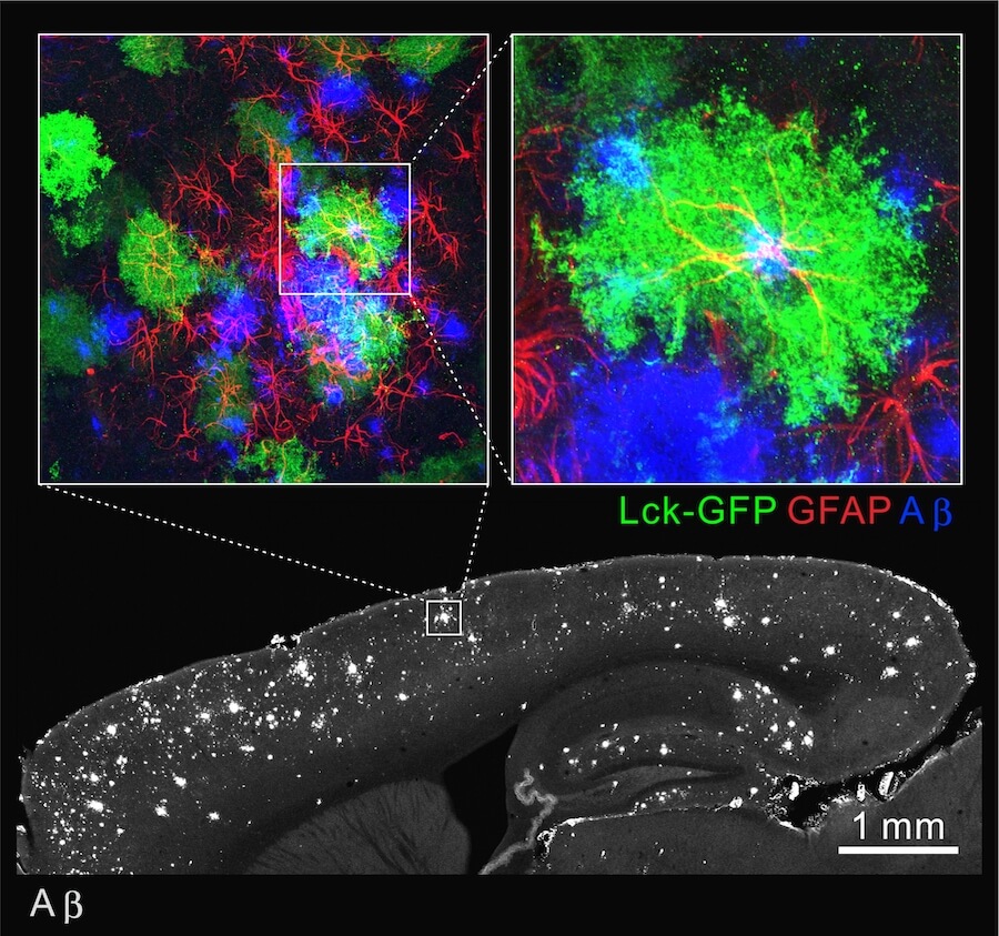 Zooming in on astrocytes interacting with amyloid in the mouse brain.