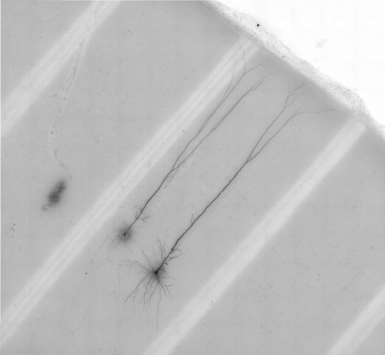Human L5 ET neurons shown with a special stain after scientists recorded their electrical activity. These neurons send projections long distances in the brain.