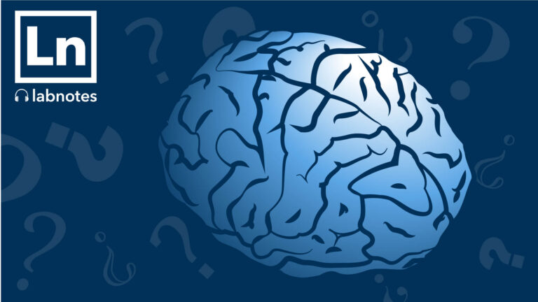 Illustration of the brain with question marks