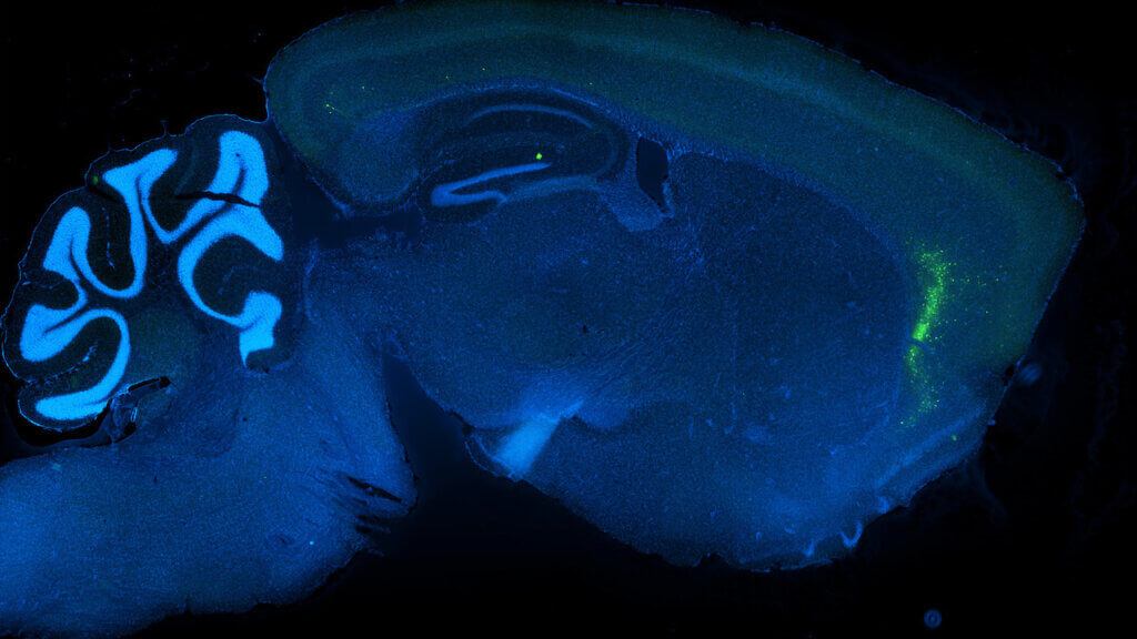A section of mouse brain in deep blue against a black background, with a cluster of green cells highlighted at the right side.
