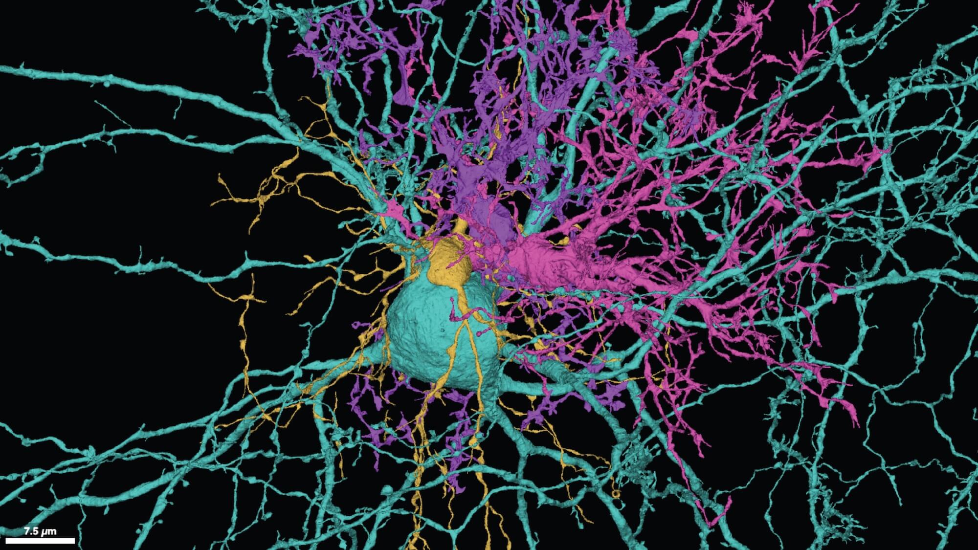 Four different kinds of brain cells are shown in high resolution. A large green neuron in the center is surrounded by different kinds of brain cells in purple, gold and pink.