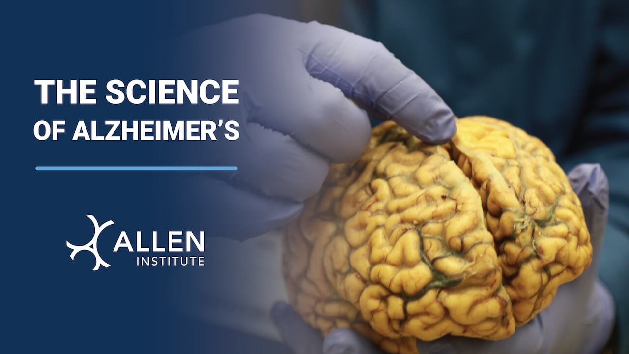 The Science Of Alzheimer’s: Brain Awareness Week 2023 - Allen Institute