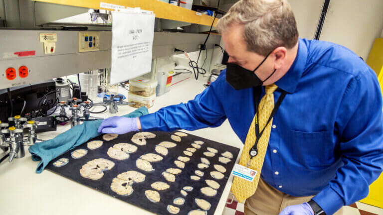 Keene points out brain slices from an 83-year old man who had died of Alzheimer's disease and donated his brain to research. The slices are preserved so that scientists can study how brain structures have changed in the disease. Photo by Erik Dinnel / Allen Institute