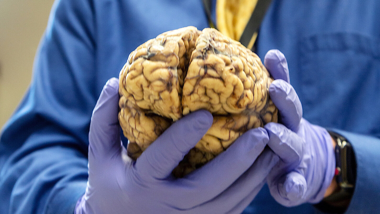 Scientist holding human brain that was donated to science