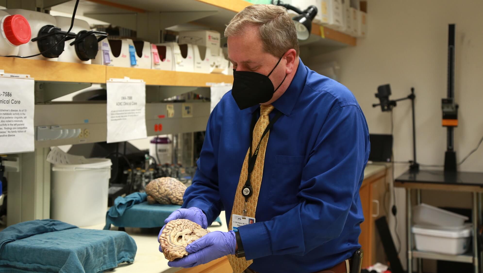 C. Dirk Keene in the lab holding a part of a human brain that was donated to science