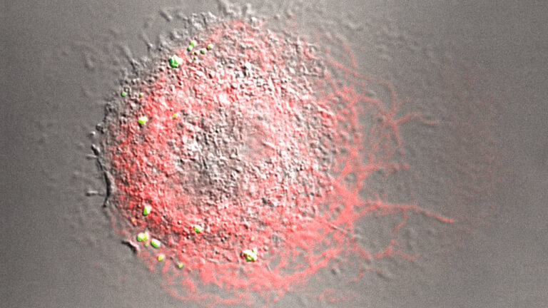 Microscopic view of a macrophage with actin highlighted in red and antibody-coated beads in yellow
