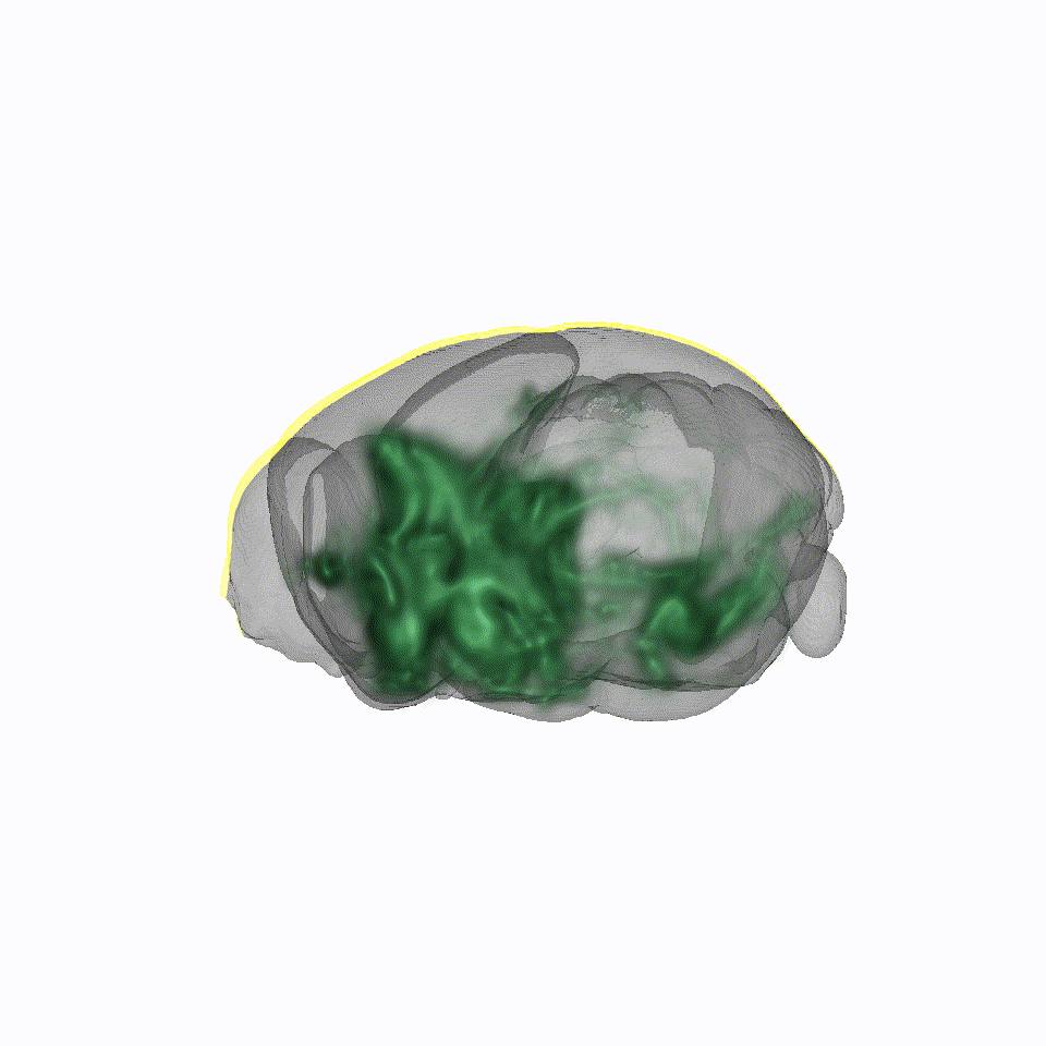 Rotating mouse brain showing viral vectors