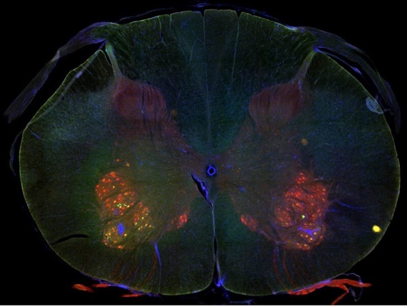 Image showing viral tools illuminating brain cells in a mouse brain