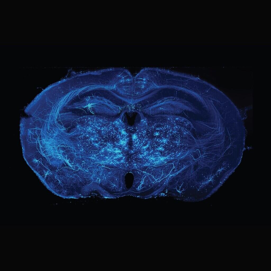 ExA-SPIM mouse brain image