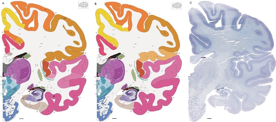 Image showing human brain sections annotated with cell type regions.