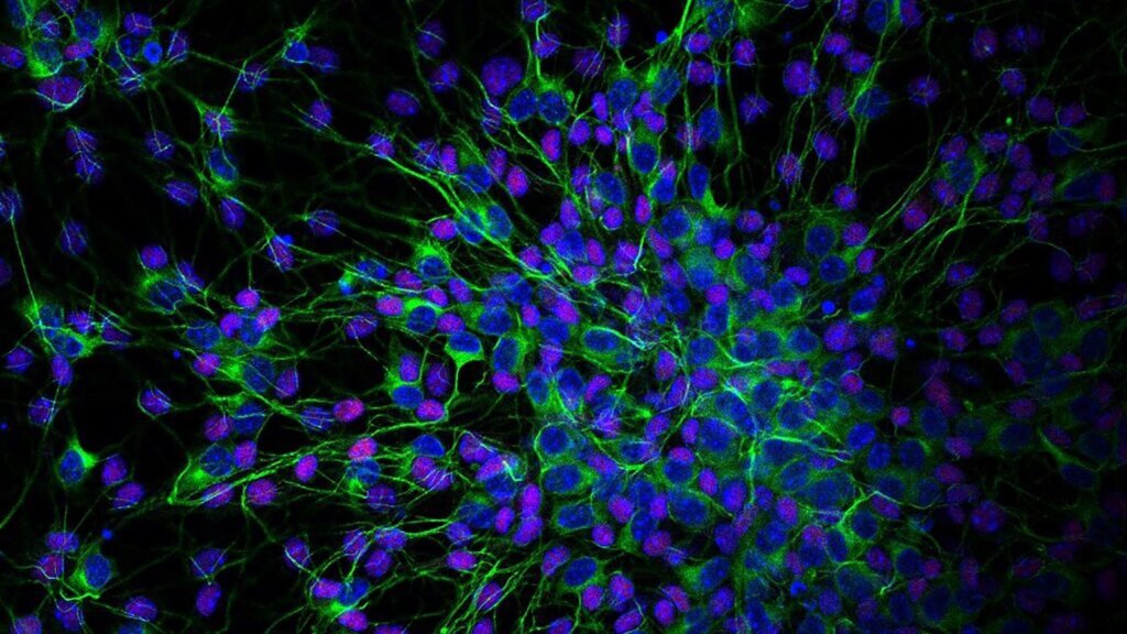 Allen Discovery Center for Neuroimmune web header showing cells