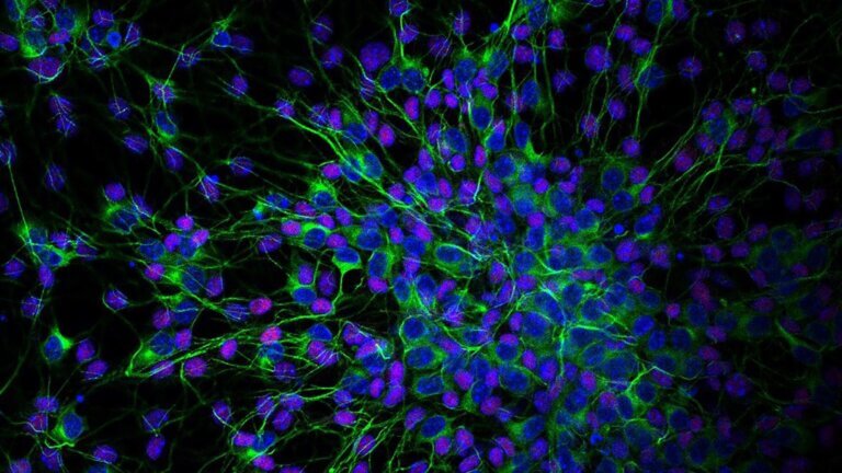 Allen Discovery Center for Neuroimmune web header showing cells