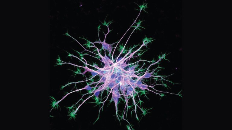 Cytoskeleton in neurons differentiating from induced pluripotent stem cells