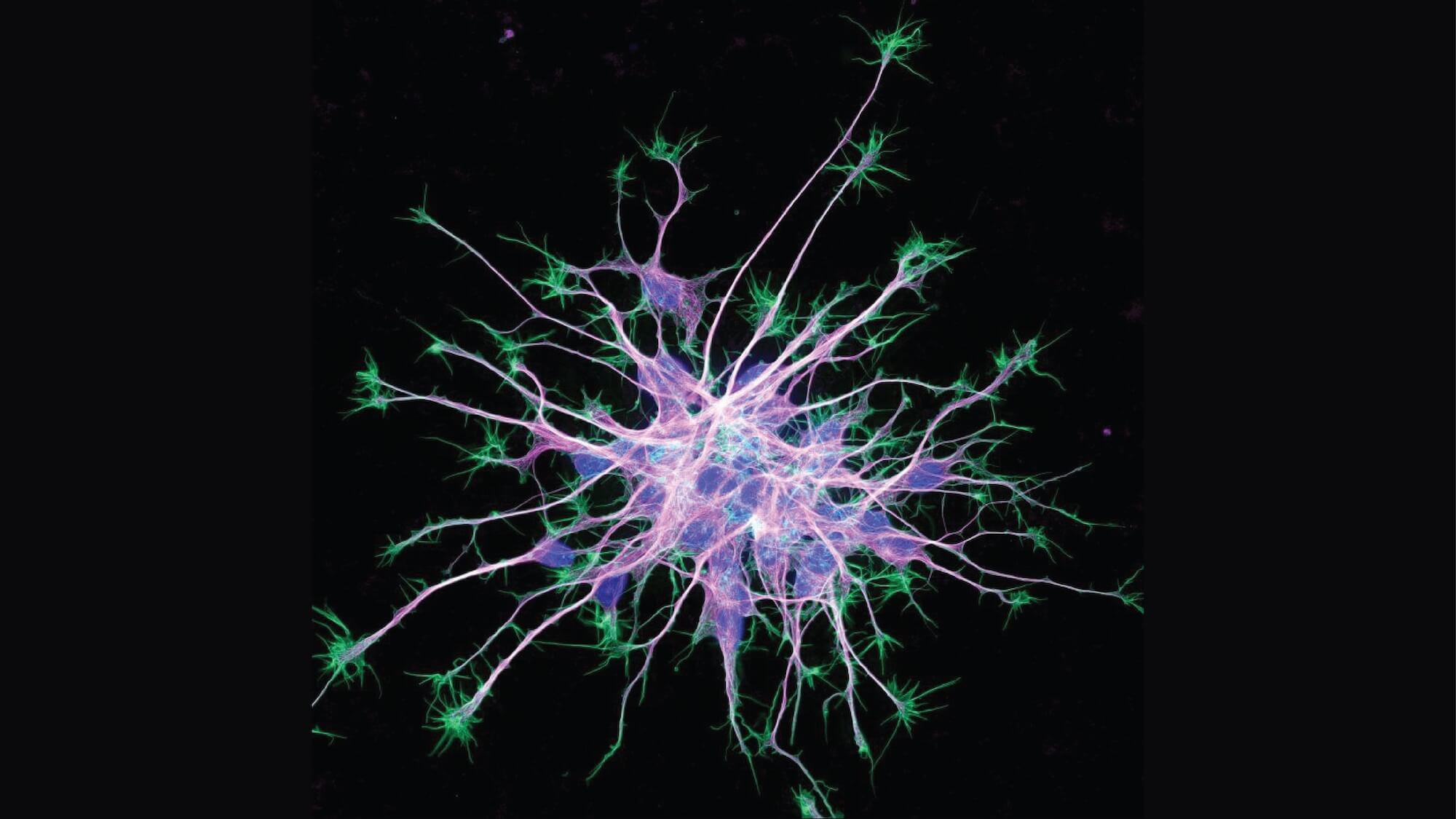 http://Cytoskeleton%20in%20neurons%20differentiating%20from%20induced%20pluripotent%20stem%20cells