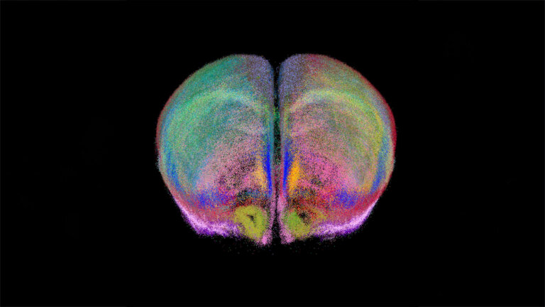 Mouse brain colorful regions