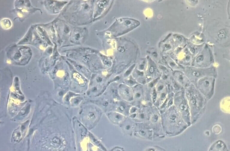 Microscope view of translucent cells that are circular in shape with dark centers