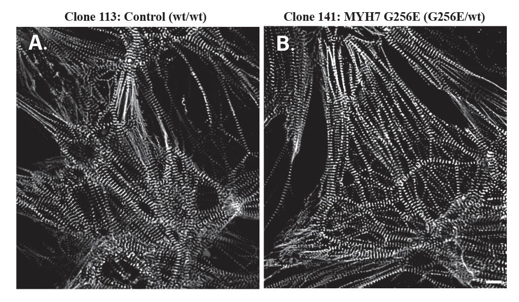 Side by side comparison of cardiomyocytes in different cells