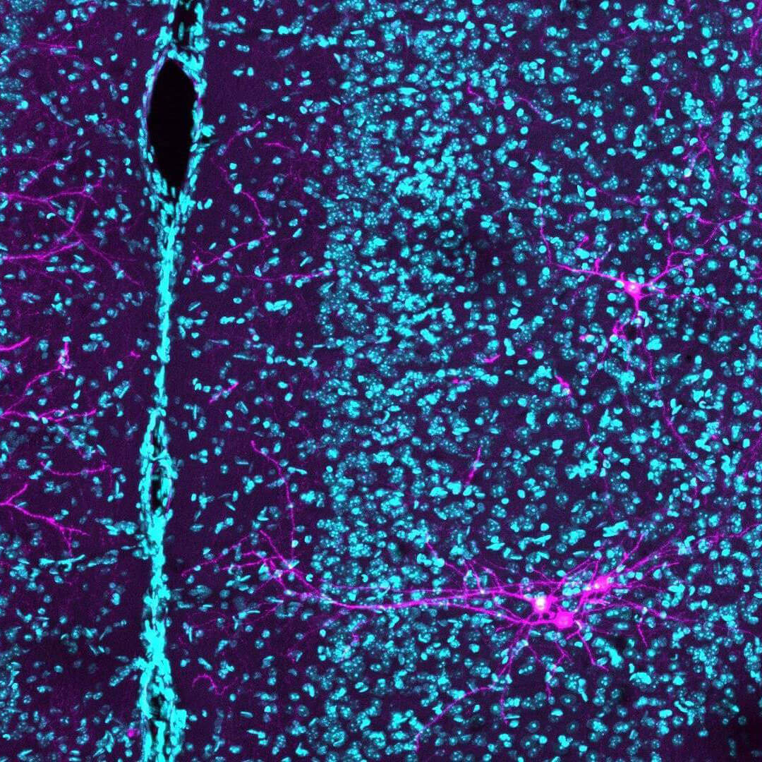 image of the brain showing many cell bodies an IT neurons emphasised